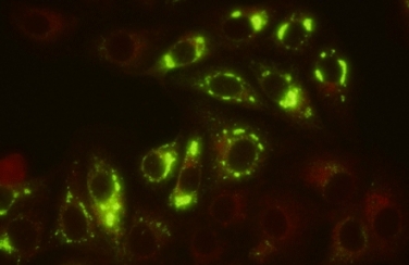 Antibodies to Yellow Fever Virus