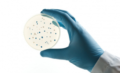 Improved recovery of ESBL-producing bacteria using chromogenic agar