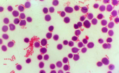 AI-enabled interpretation of Gram stains