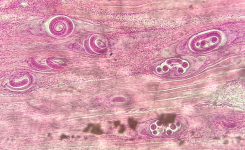 Detection of Meat Borne Parasites
