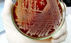 Faster AST reporting equals better outcomes