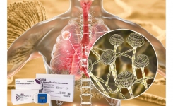 Asp galactomannan lateral flow kit