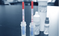 Cryptococcal Antigen Lateral Flow Assay