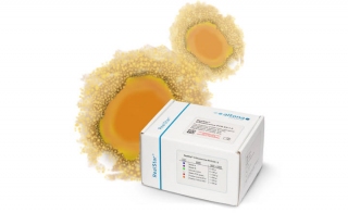 altona Diagnostics Releases Real Time PCR Monkeypox Virus Kit