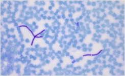 Anthrax Control Positive Slide