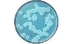 petri dish