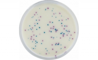 IRIS <em>Salmonella</em>, a Negative Screening Within 37 Hours