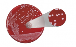 white colonies growing on red microbiological cuture media