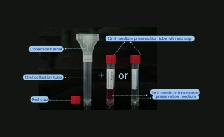 Saliva Collection Kit for COVID-19 Specimens With Classic or Inactivated Medium