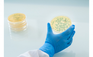 Reduce Costs and Environmental Impact of <em>Listeria </em>Testing with ALOA<sup>®</sup> ONE DAY