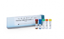 FluoroType SARS-CoV-2 varID Q PCR Assay