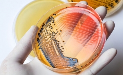 Salmonella growing on SS agar