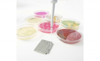 Rapid Microorganism Identification with MALDI Biotyper