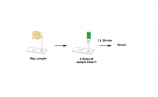 US FDA Grants EUA to First IgG IgM Lateral-Flow COVID-19 Assay