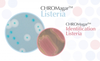 CHROMagar™, a Unique and Rapid Solution for Detection of <em>L. monocytogenes</em> in Food Samples