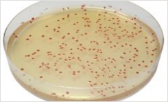 Chromogenic media for Campylobacter