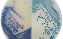 Chromogenic media for mastitis organisms