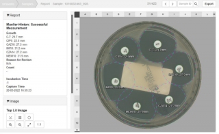 Automated Disc Diffusion Plate Reading For The Detection of AMR