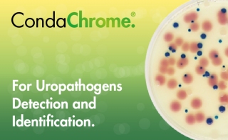 UTIC: CondaChrome for Uropathogens Detection and Identification