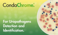 Chromogenic media for uropathogens