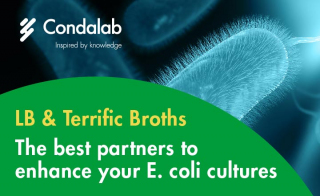 The Perfect Media for Your Cultures With Recombinant em E coli em 