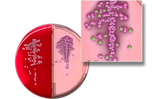 Another Giant Step in the Evolution of Artificial Intelligence in Clinical Microbiology