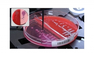FDA Clearance of COPAN rsquo s Colibri trade Automated Rapid Bacterial Identification