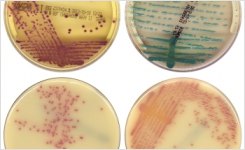 Automatic MRSA reading on chromogenic media