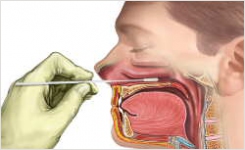 Training Material Facilitates Proper Nasopharyngeal Sample Collection