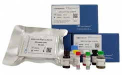 sars cov 2 immunoassay kits for research