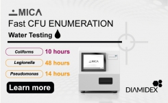 Automated Colony counters for water testing