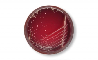 Actinomyces ndash Current Research Review