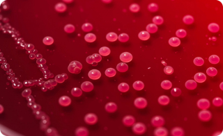 Why Are Anaerobic Diagnostics Gaining Renewed Attention 