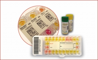 ELITech is Launching its New Mycofast reg to Detect Urogenital Mycoplasma 