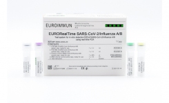 PCR Test SARS-CoV-2 and Influenza