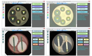 BIOMIC V3 Adds Image Filters for Disk Diffusion and MIC Strip Plates
