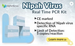 Nipah Virus Real Time PCR Kit