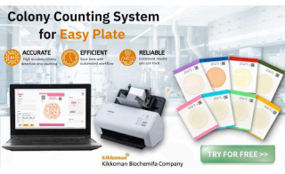 Automated Colony Counting for Easy Plate: Fast, Accurate Results