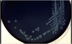 Campylobacter Blood Free Selective Medium Modified CCDA 