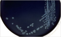 Campylobacter Culture from Lab M