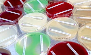 Solutions for Antimicrobial Susceptibility Testing