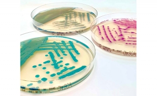Liofilchem 39 s Certification to IVDR