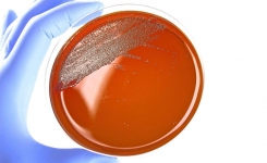 petri dish