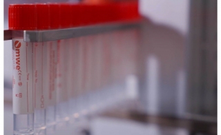 Using the Right Specimen Collection Product for Monkeypox