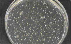 New TOS MUP Medium for Enumeration of Bifidobacteria