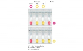 A Simple Colorimetric Alternative to Gold-Standard COVID-19 Testing nbsp 