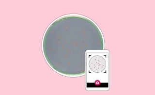 Ready to Use Agar Plate Manufacturers Add Value With Smartphone Colony Counter