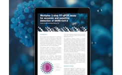 Multiplex RT-qPCR assay for SARS-CoV-2 and Winter viruses