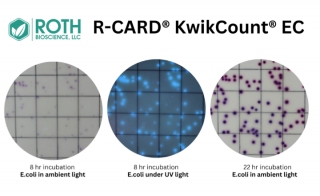 Get Your em E coli em Test Result on the Same Day by using R-CARD sup reg sup KwikCount sup reg sup EC