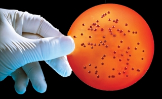 Pre-Poured em Burkholderia Cepacia em Selective Agar BCSA nbsp 